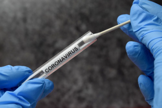 Gloved hands holding a swab and a tube. The tube has the label “Coronavirus”. 